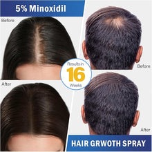 Load image into Gallery viewer, 5% Minoxidil Hair growth Spray for Women and Men: Anti Hair Loss Treatment for Hair Regrowth 2 Month Supply, Extra Strength Scalp Solution, Thicken Strengthen Longer Hair 100Ml
