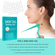 Load image into Gallery viewer, Skin Tag Removal Tool
